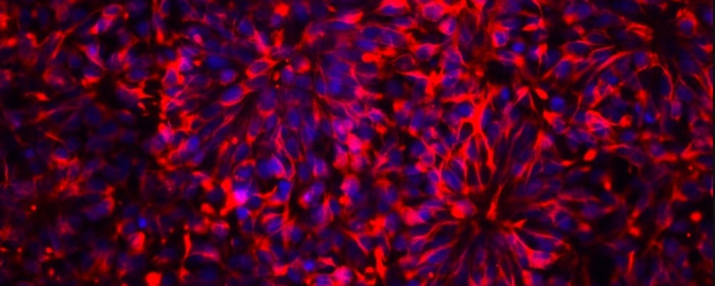 Neurons derived from human embryonic stem cells